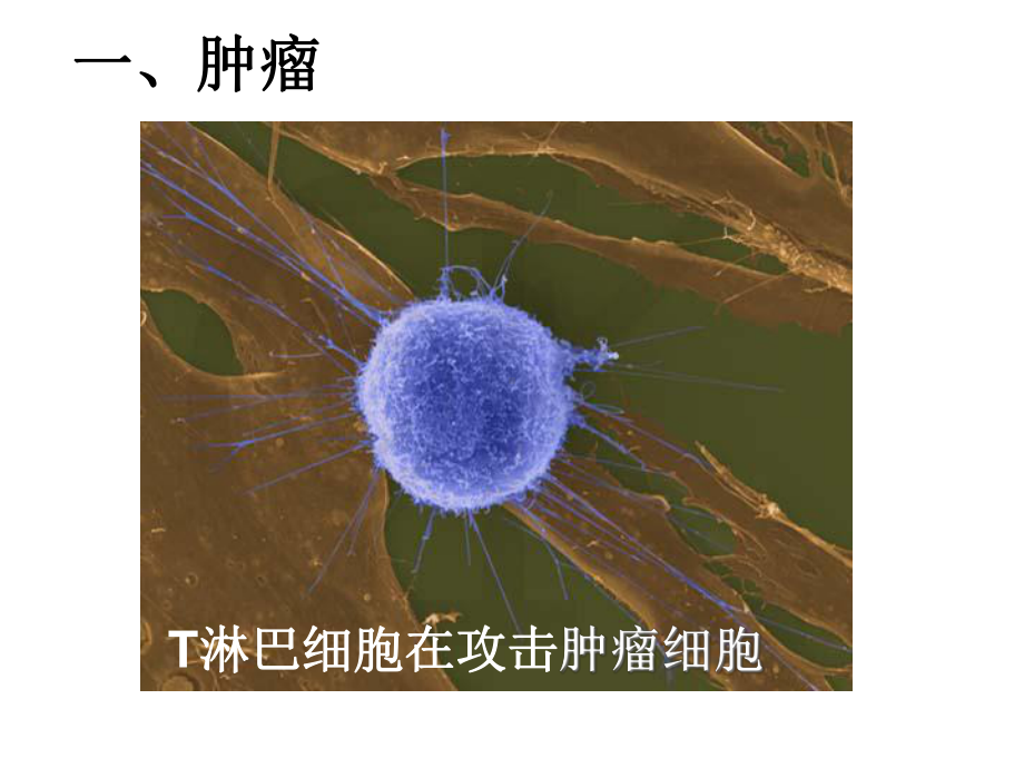 3.4非传染性疾病-课件(浙教版九年级科学下册).ppt_第2页