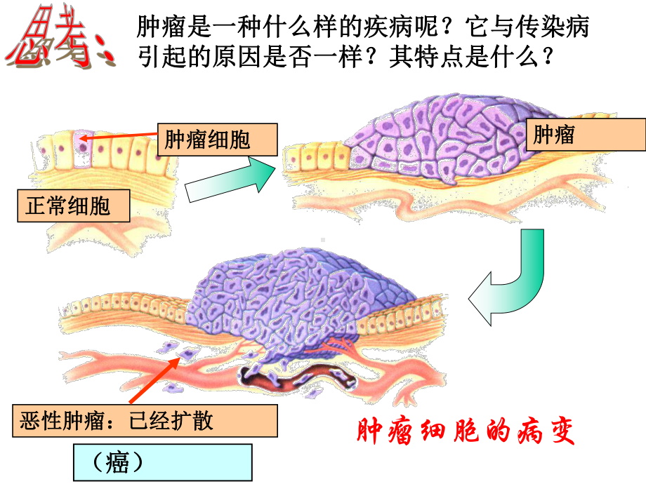 3.4非传染性疾病-课件(浙教版九年级科学下册).ppt_第3页