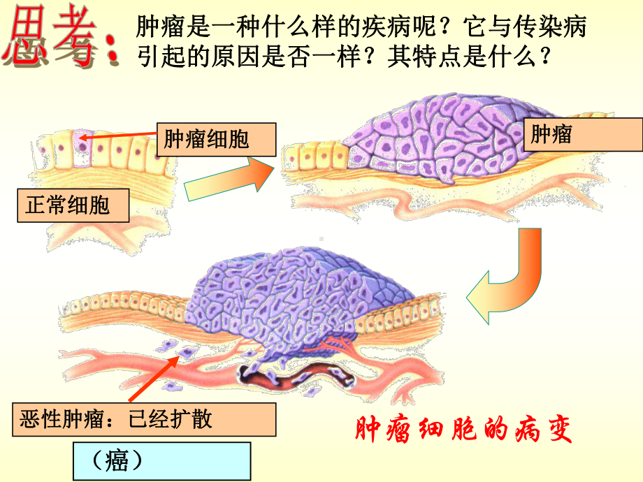 34非传染性疾病课件(浙教版九年级科学下册).ppt_第3页