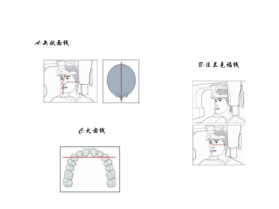 (完整)牙片机拍摄程序定位ppt.ppt_第3页