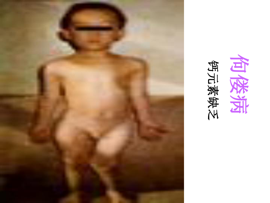 12.2-化学元素与人体健康-课件-(新人教版九年级下册).ppt_第3页