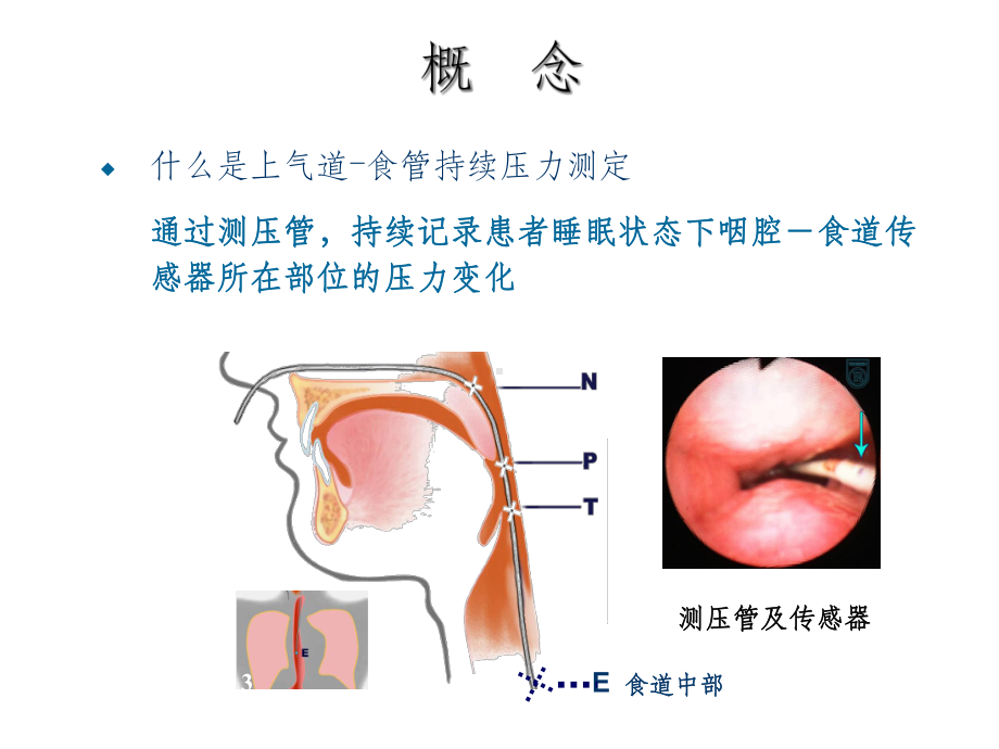 上气道食道压力监测技术.ppt_第3页