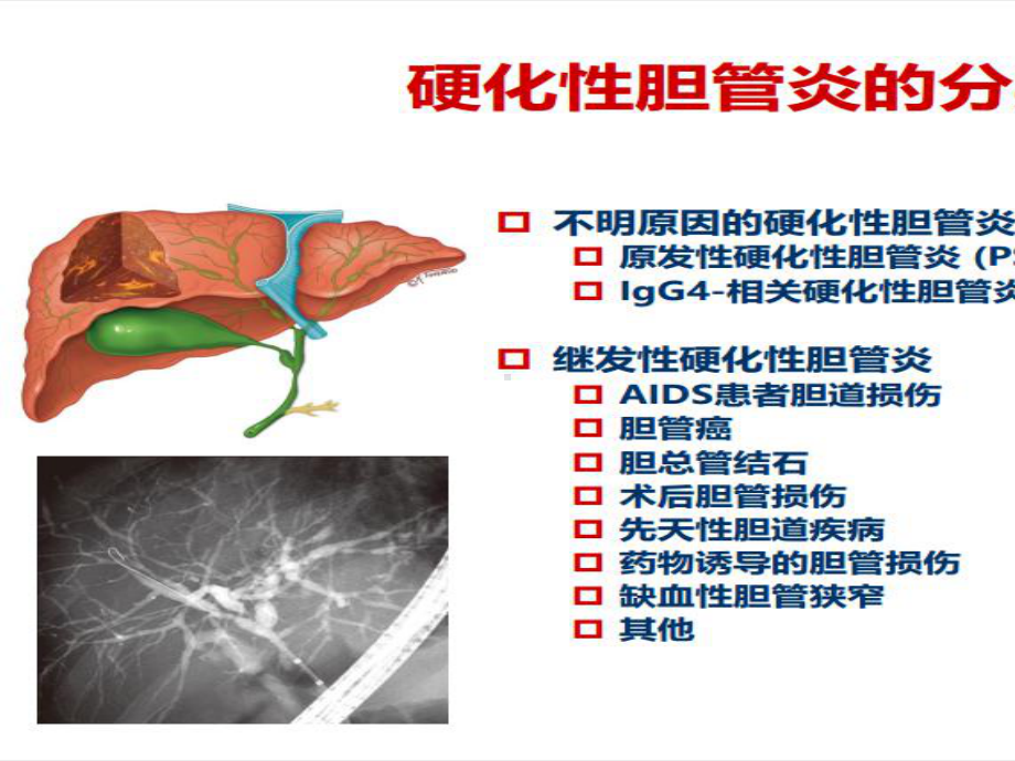 igg4相关肝胆疾病的诊断与治疗课件.pptx_第3页