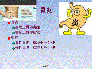 急性胃炎课件急性胃炎护理查房[文字可编辑].ppt