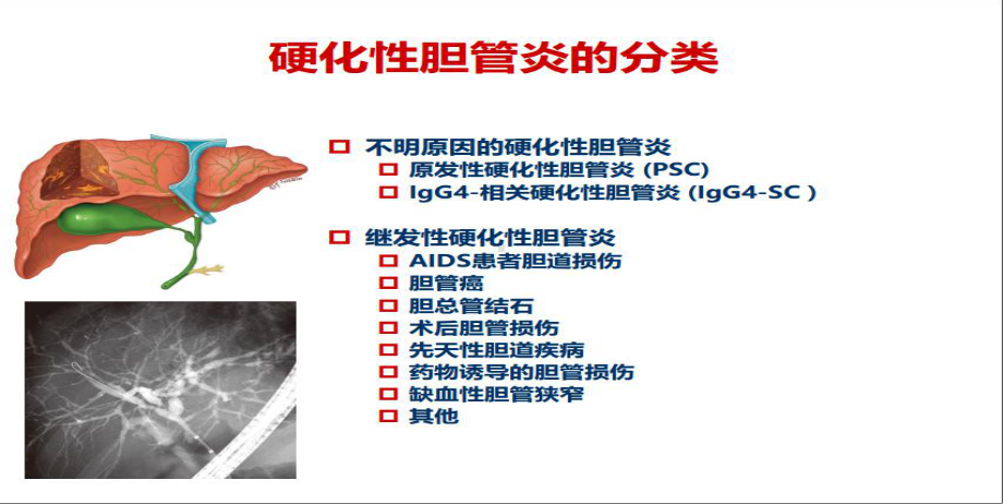 igg4相关肝胆疾病的诊断与治疗课件2.pptx_第3页