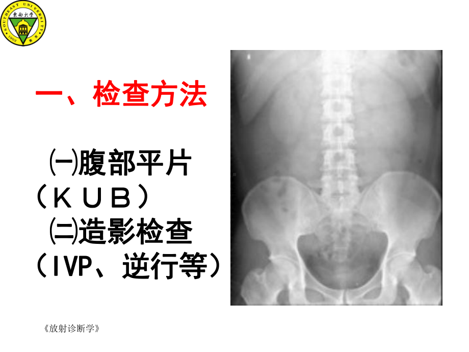 泌尿系统X线诊断精选课件.ppt_第2页