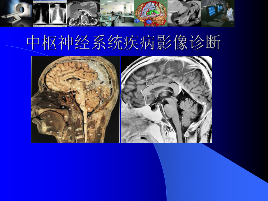 中枢神经系统疾病影像诊断.ppt_第1页