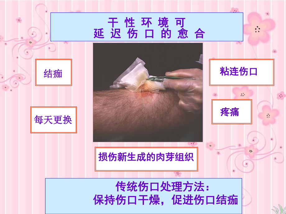 《伤口敷料》课件37p(同名19).ppt_第3页