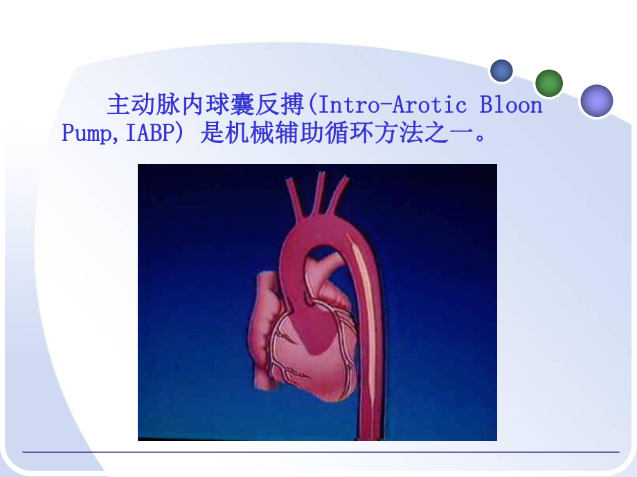 主动脉球囊反搏iabp的应用和护理课件.ppt_第3页