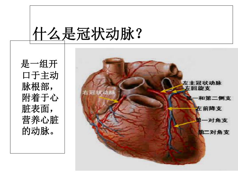 冠心病介入治疗及护理.ppt_第2页