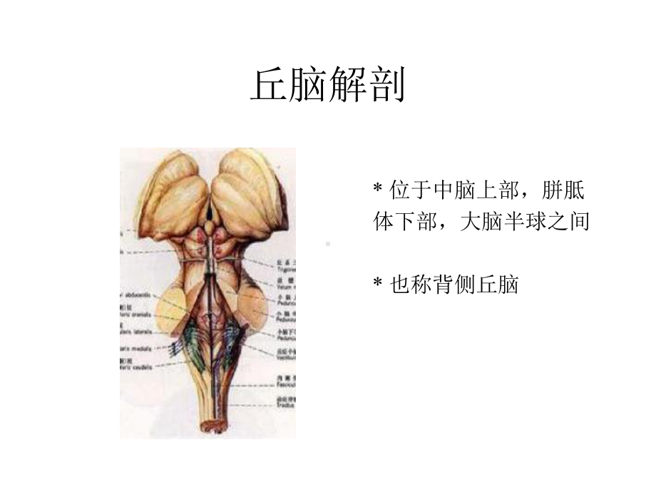 丘脑梗塞-医学精品.pptx_第2页