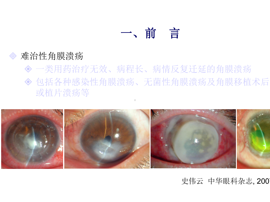 常用眼表小手术临床应用(难治溃疡).ppt_第3页