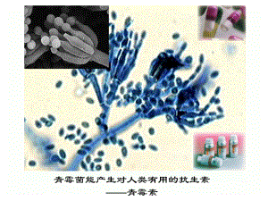 人教版高一生物必修二教学课件62基因工程及其应用(共31张).ppt