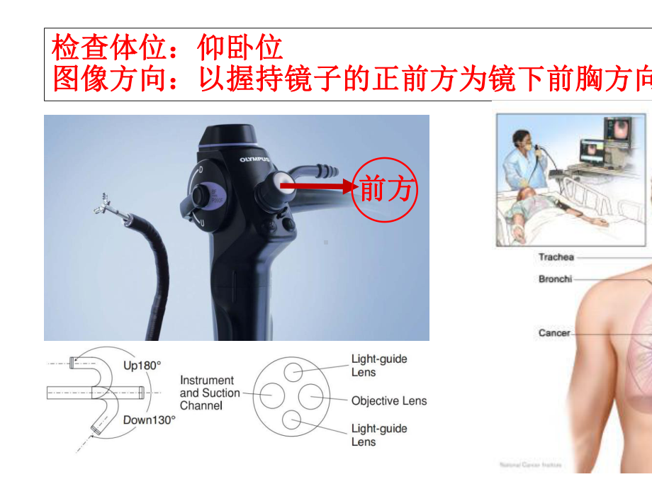 支气管镜图谱立体解读-课件.ppt_第2页