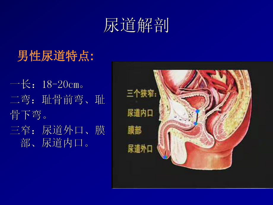 导尿及注意事项课件2.ppt_第3页