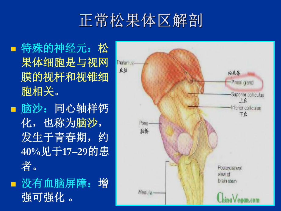 松果体区肿瘤课件医学.ppt_第3页