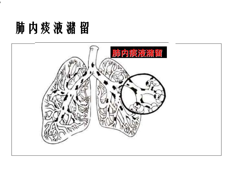 肺部物理治疗在重症病人中的应用课件.ppt_第2页