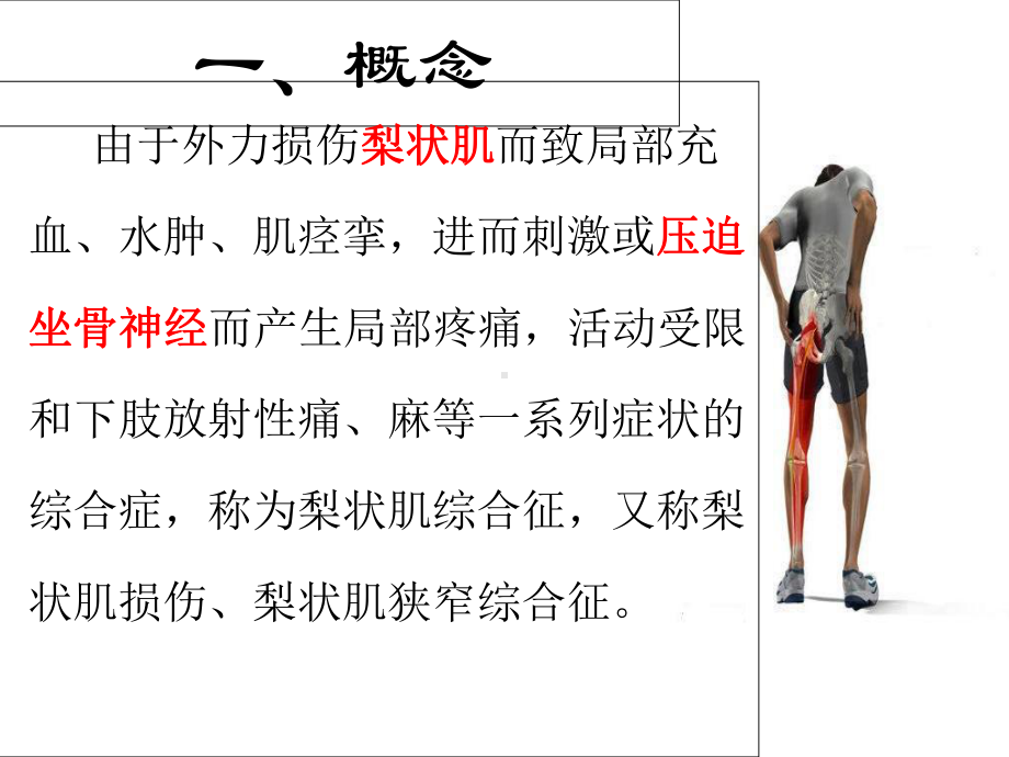 梨状肌综合征课件.ppt_第2页