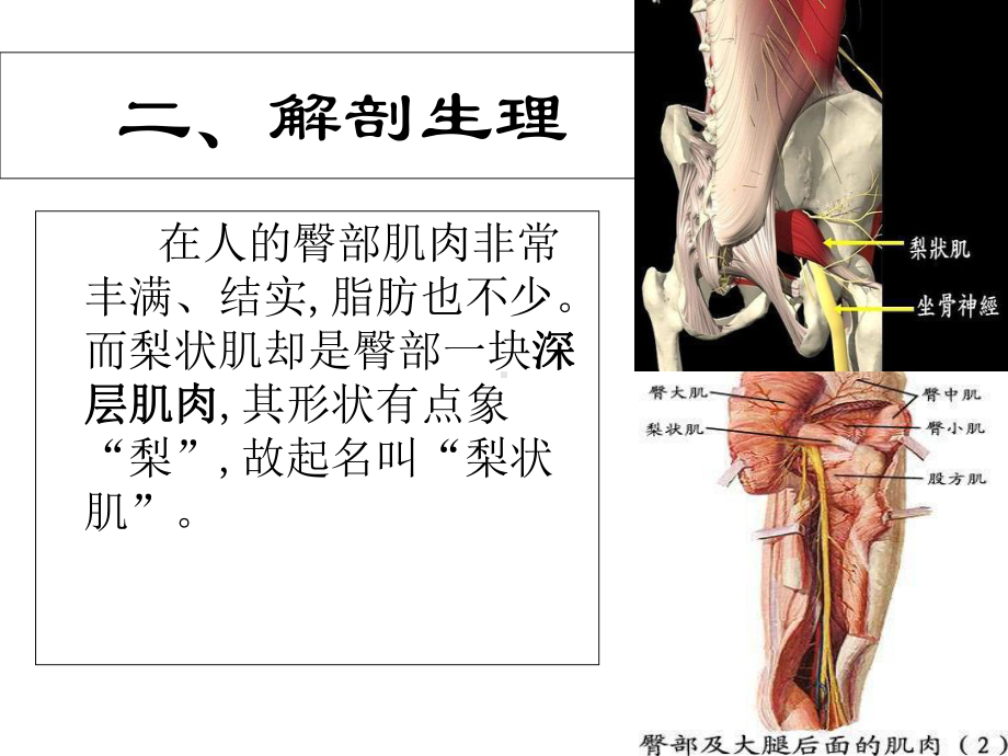 梨状肌综合征课件.ppt_第3页