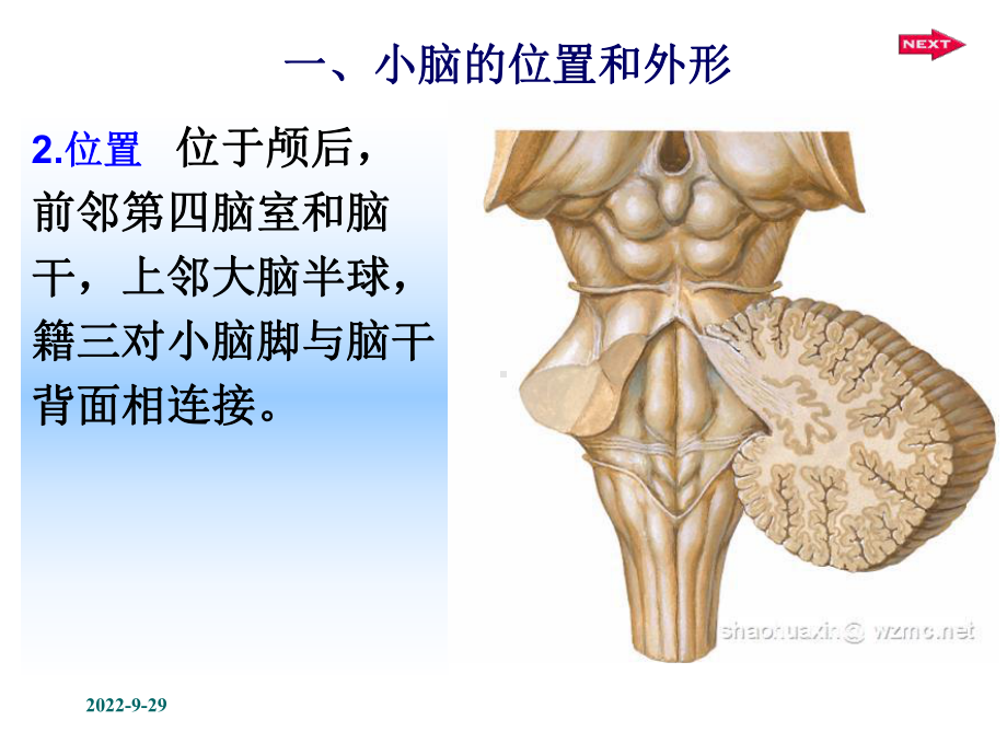 中枢神经系统小脑医学.ppt_第3页