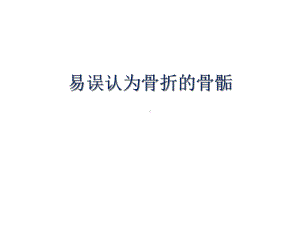 易误认为骨折的骨骺张晓春医学课件.ppt