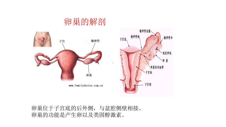 腹腔镜下卵巢囊肿剥除术配合课件.pptx_第3页