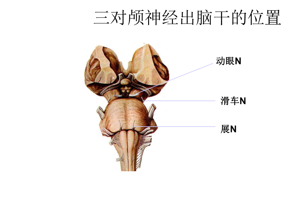 （精品）痛性眼肌麻痹PPT资料.pptx_第2页