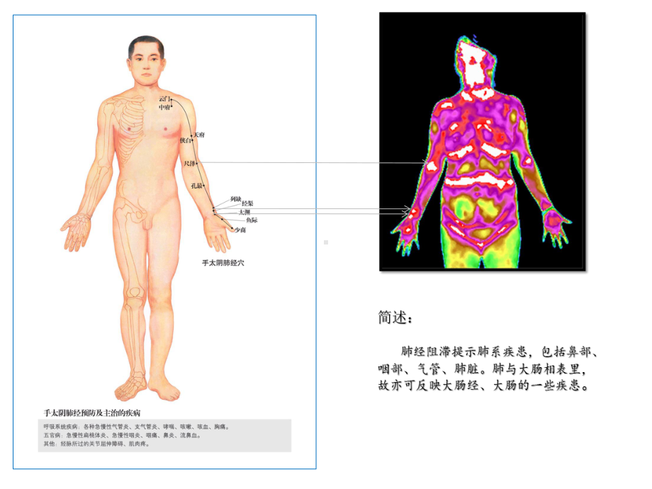 中医与红外-课件.pptx_第3页