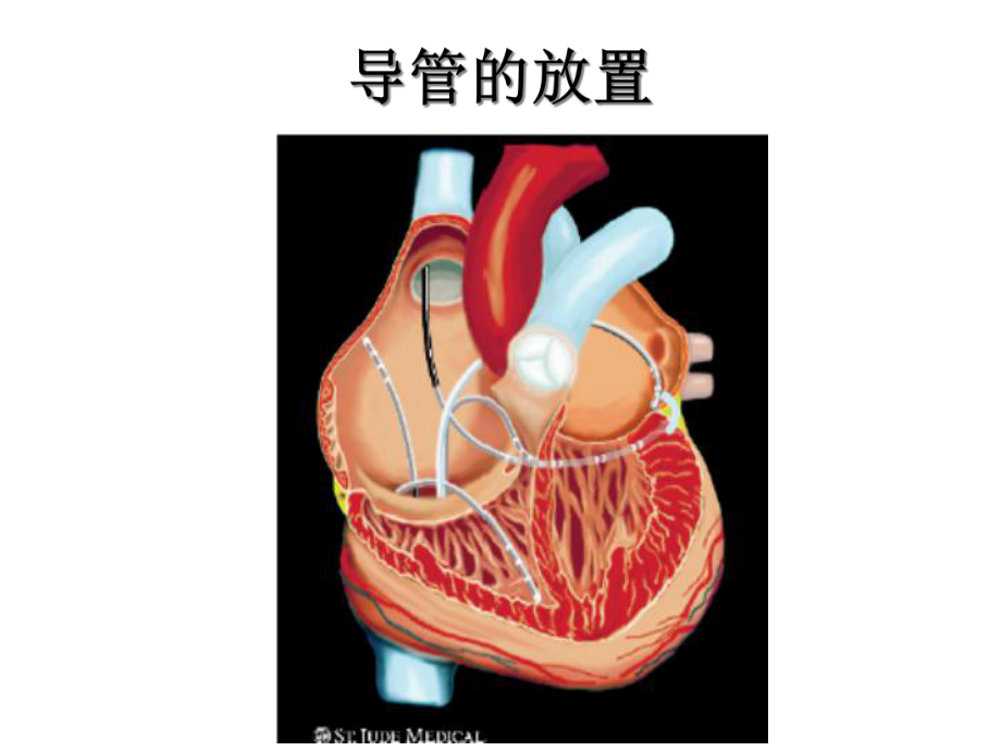 心内电生理检查.ppt_第2页