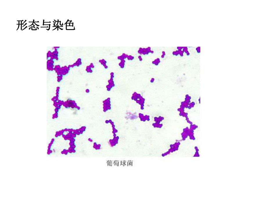 万古霉素临床应用简述-医学资料.ppt_第3页