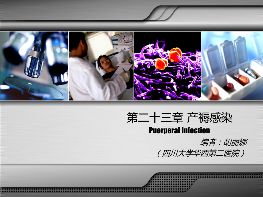 《产褥感染》课件.ppt_第2页