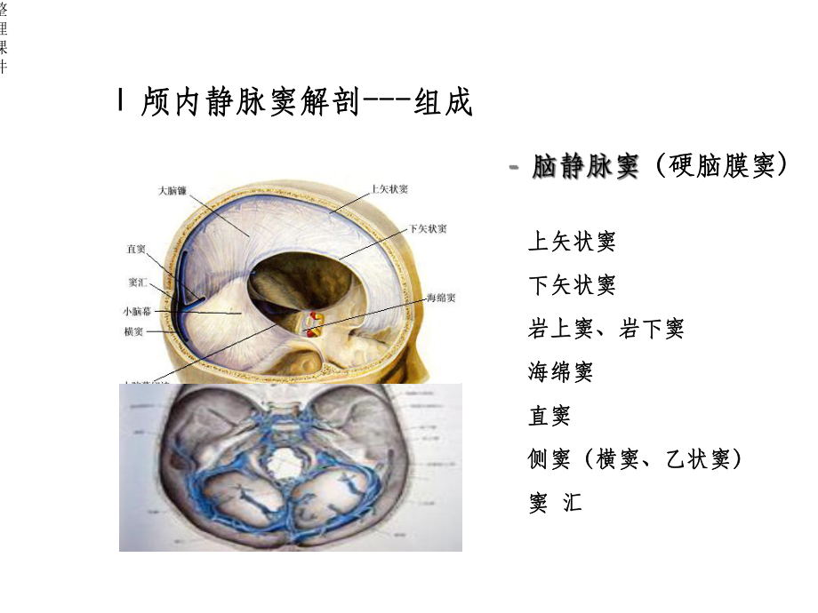 颅内静脉窦血栓形成的影像学表现课件1.ppt_第3页