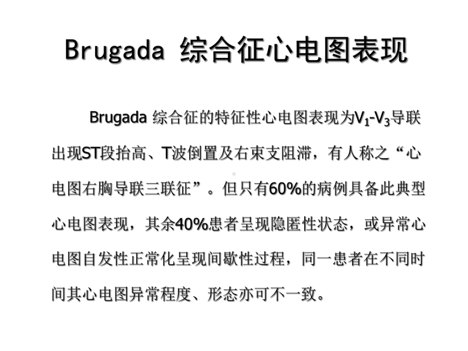 Brugada综合征心电图药物激发试验-精品文档.ppt_第2页