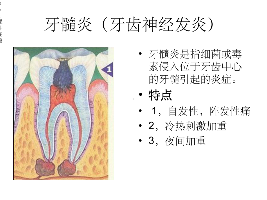 口腔常见疾病的诊治.ppt_第3页