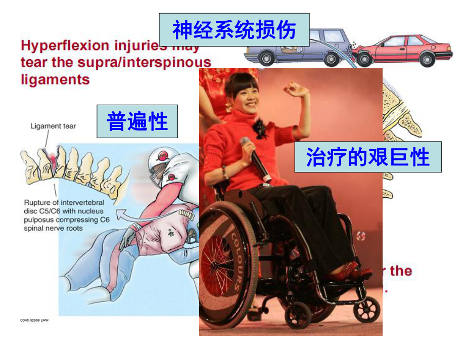 脑损伤修复与再生课件.ppt_第1页