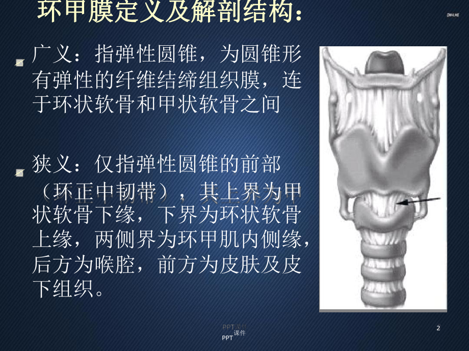 环甲膜穿刺术课件.ppt_第2页