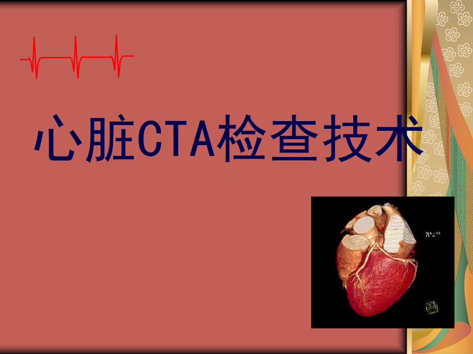 《心脏cta检查》课件2.ppt_第1页