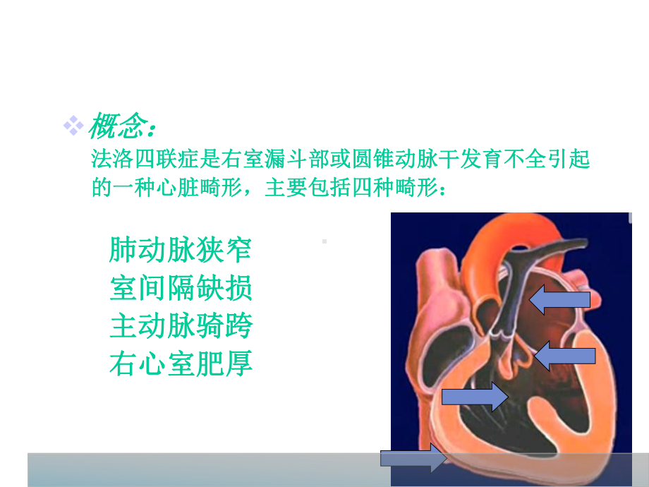 tof法洛四联症-课件.ppt_第2页