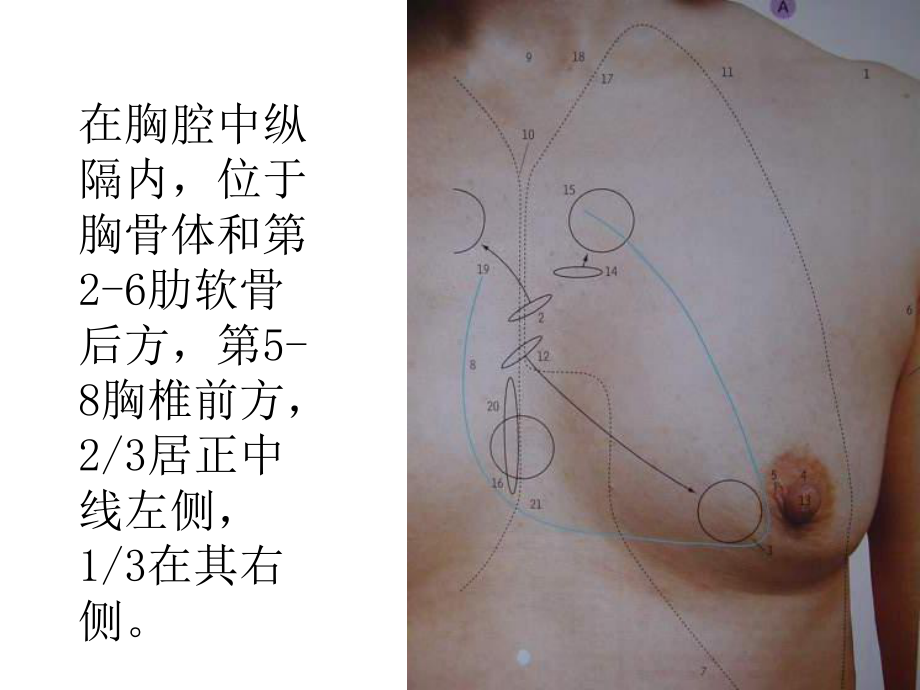 心脏视诊、触诊.ppt_第3页