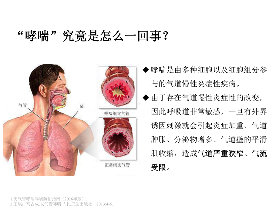 成人哮喘不可不知的危害.pptx_第3页