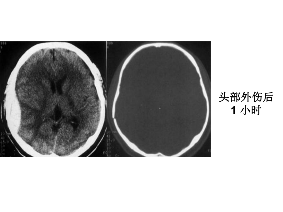 CT读片练习-课件.ppt_第2页