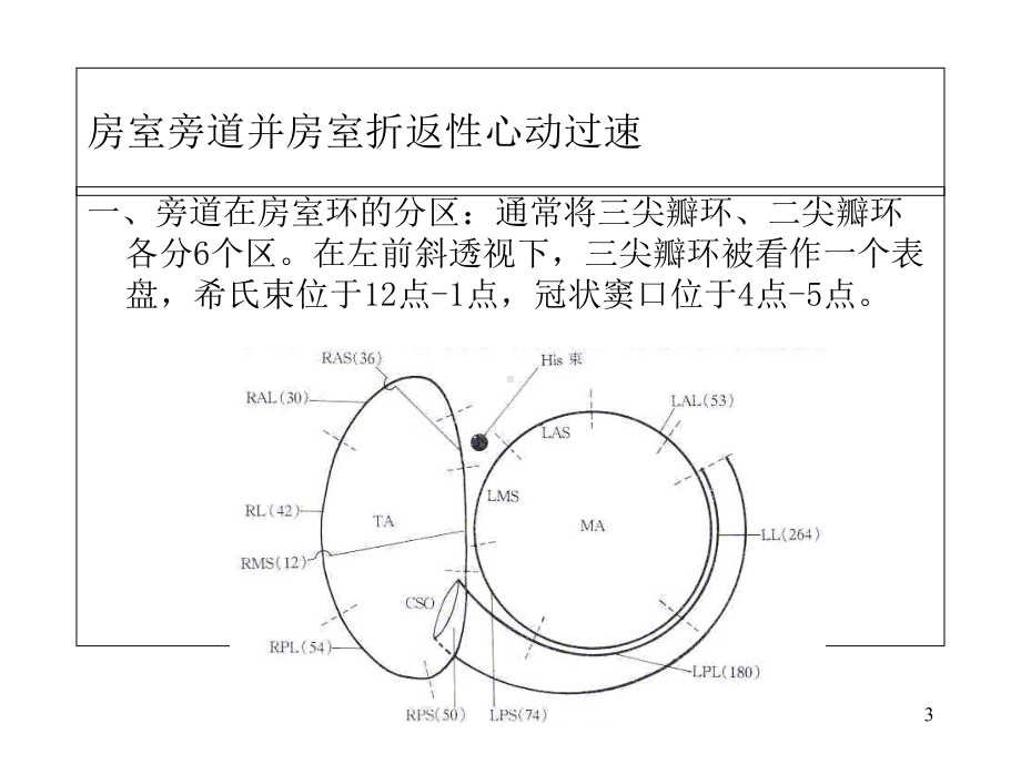 室上性心动过速的射频消融.ppt_第3页