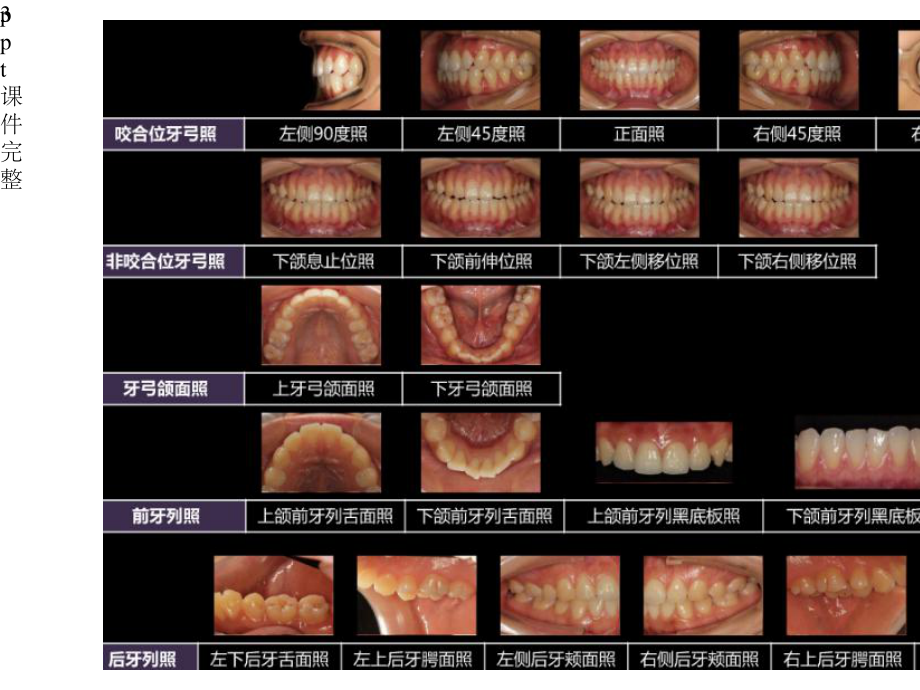 口腔医学美学第三章-口腔摄影.pptx_第3页