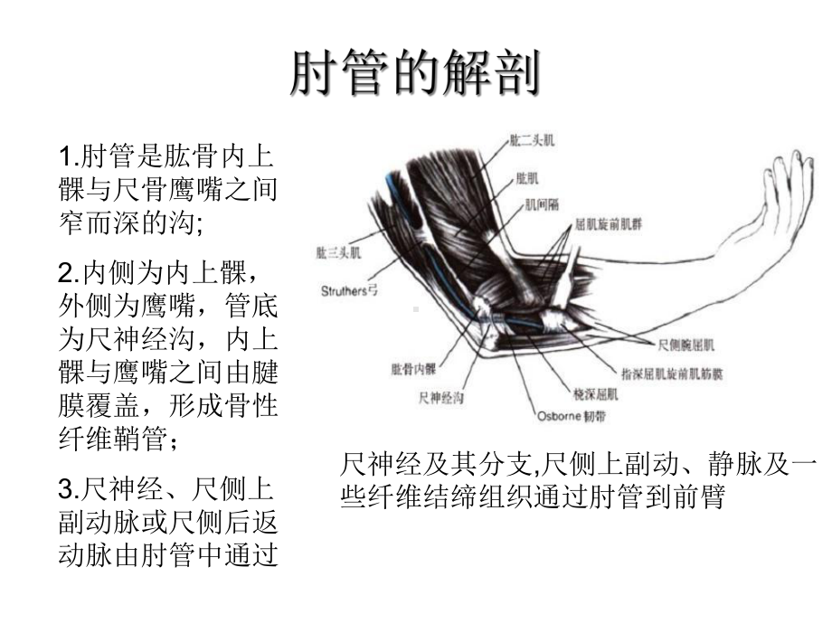 《肘管综合征》幻灯片PPT.ppt_第3页