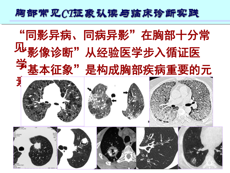 肺部CT十大入门征象课件.ppt_第2页