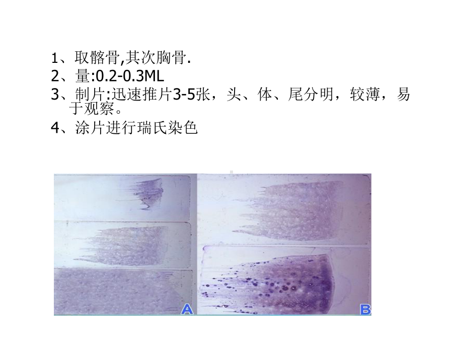 正常骨髓形态学检查课件.ppt_第3页