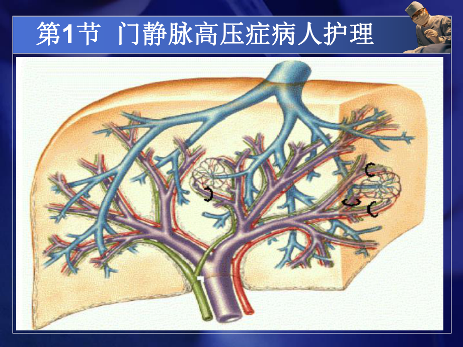 中职外科护理第三版课件第19章肝胆疾病课件.ppt_第2页