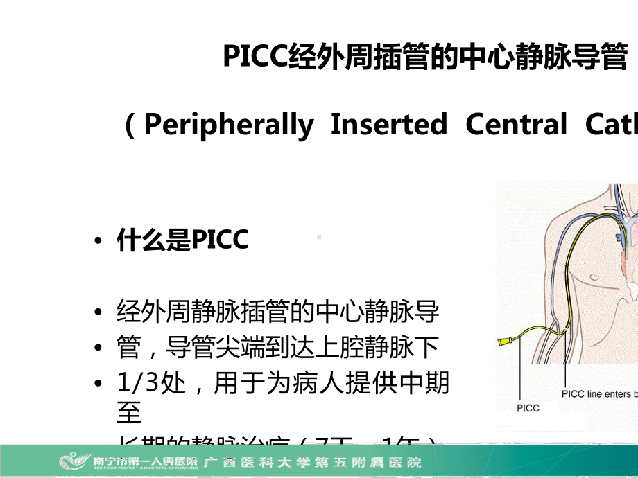 医院管理案例-超声引导下MST置管技术应用.pptx_第2页