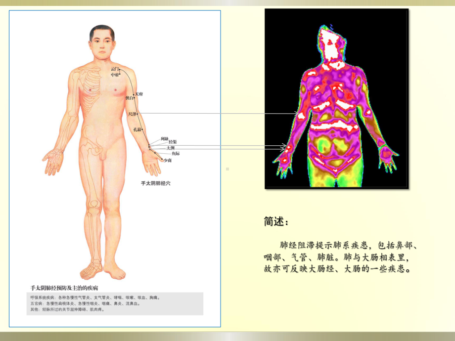 中医与红外课件.pptx_第3页