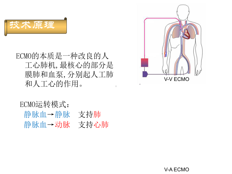 ECMO治疗危重患者进展2021优秀文档.ppt_第2页